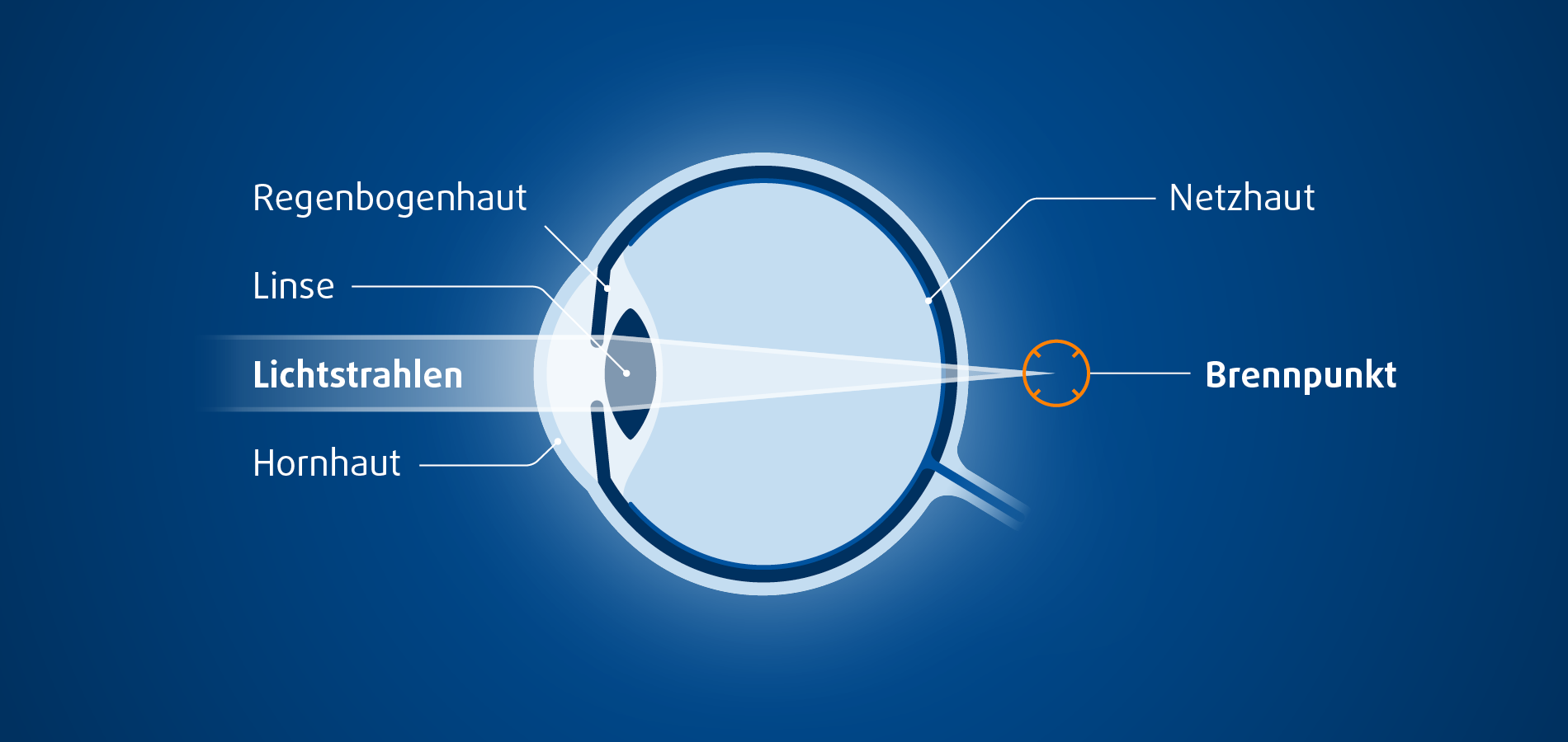 diagnose-weitsichtigkeit-cabinet-de-chirurgie-r-fractive